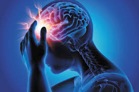 Headache Symptoms